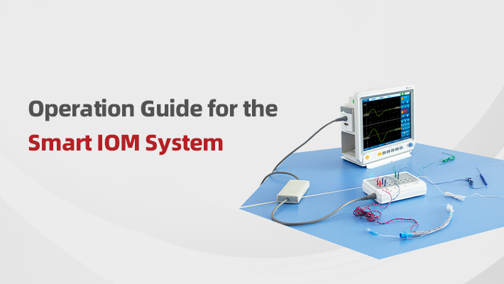 Vidéo sur le fonctionnement de Smart IOM