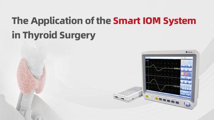 Vidéo sur le fonctionnement de Smart IOM
